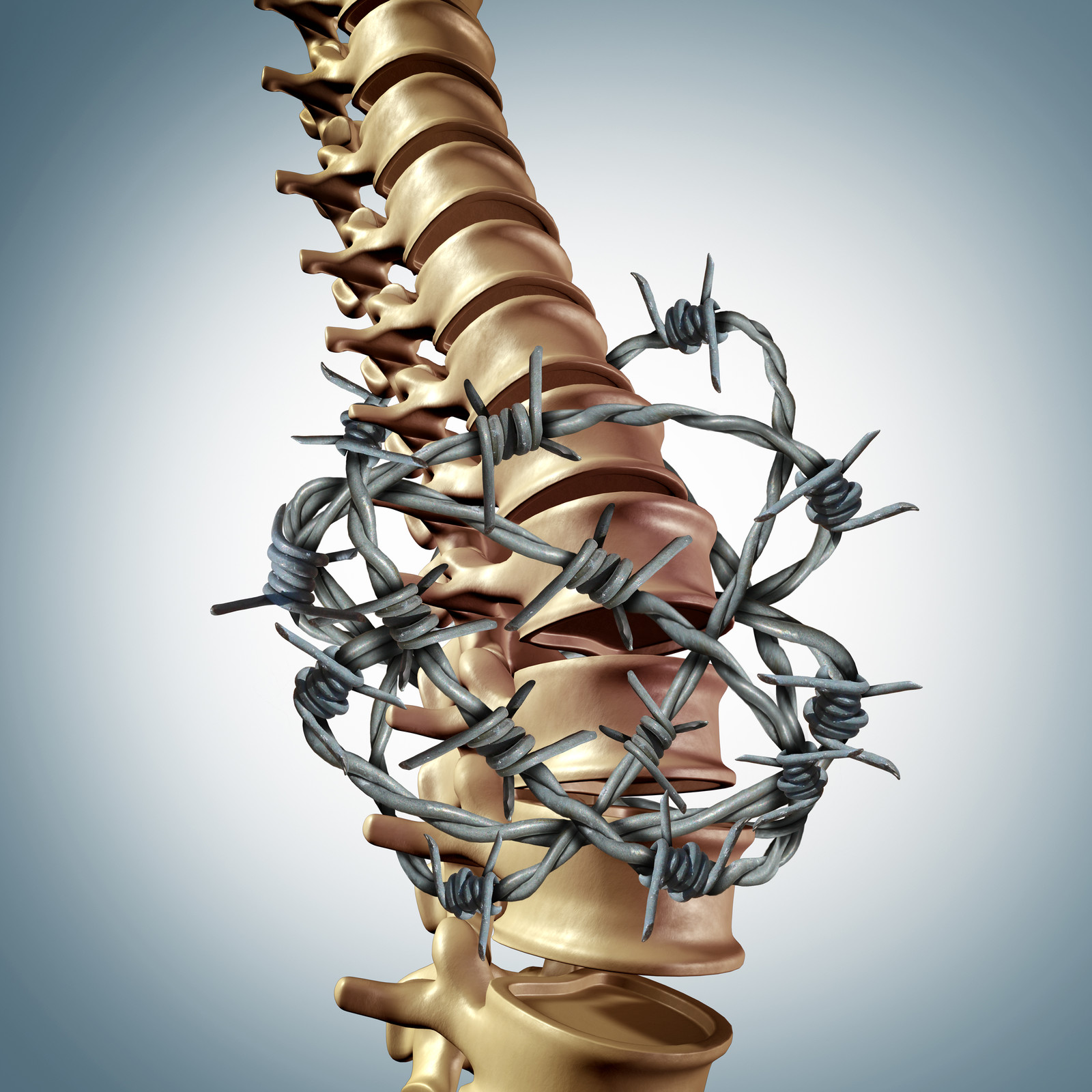 Barbed Wire Back Pain - Workers Comp - Boxer & Gerson Attorneys at Law, LLP